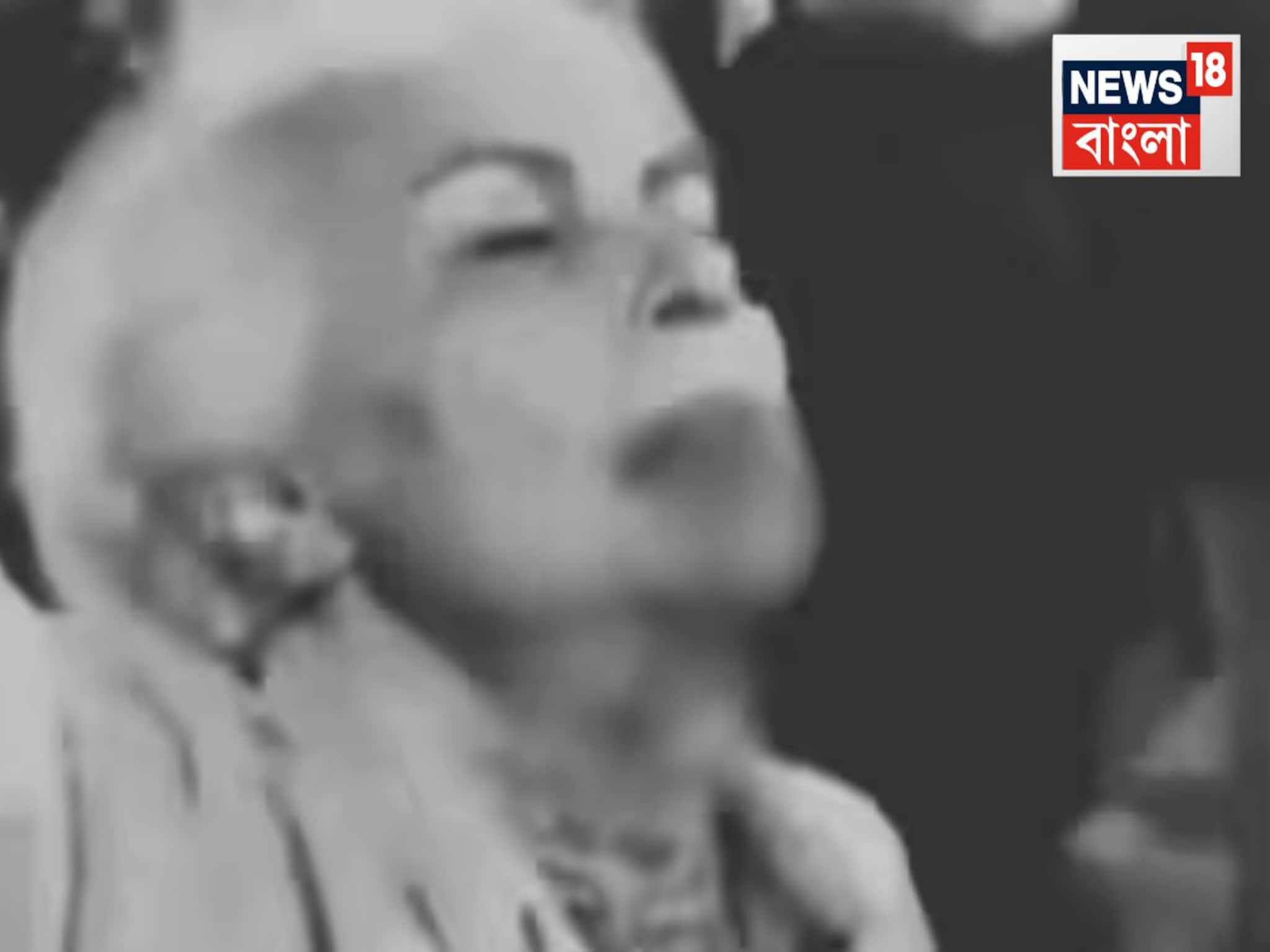 মুখ দিয়ে গল গল করে ঝরছে রক্ত! গণবিক্ষোভের ‘মুখ’ এখন এই বৃদ্ধা, আগুন জ্বলছে ইরানে