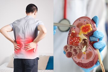 কিডনিতে পাথরের সমস্যায় ভুগছেন? সাধারণ এক পানীয়তেই শরীর থাকবে আদ্র, গায়েব 'কিডনি স্টোন'