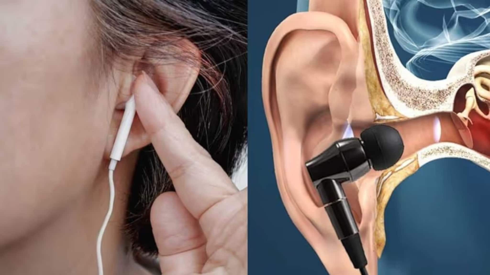 Earphones Risks: ডাক্তারদের সতর্কবার্তা: বেশি ইয়ারফোন ব্যবহারে স্থায়ী ক্ষতি হতে পারে কানে!