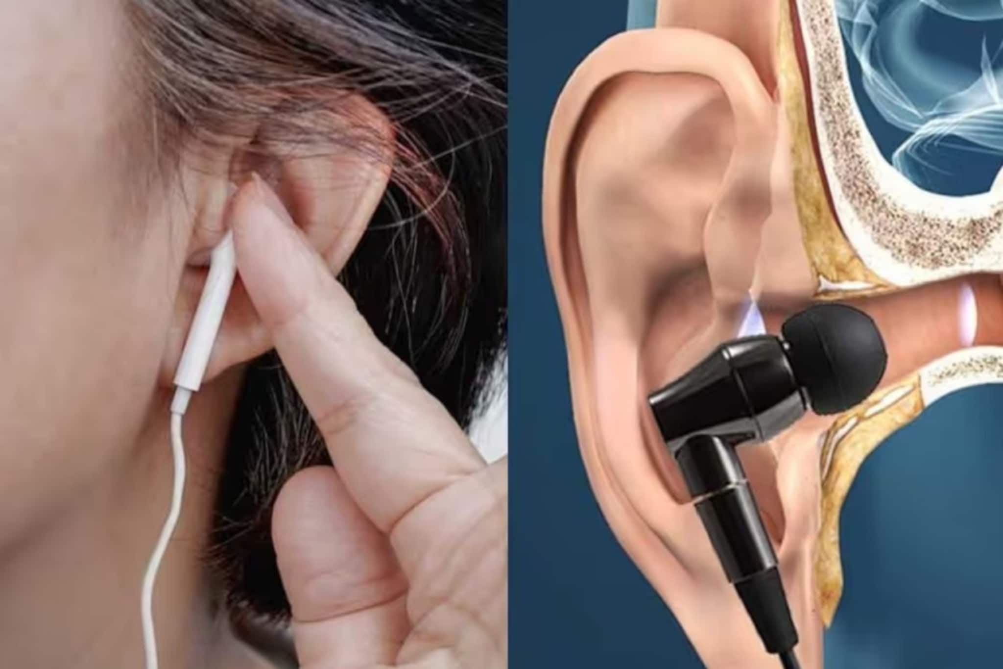 ডাক্তারদের সতর্কবার্তা: বেশি ইয়ারফোন ব্যবহারে স্থায়ী ক্ষতি হতে পারে কানে!