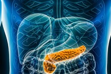 Pancreatitis: পেটের উপরে বাঁ-দিকে ব্যথা কিন্তু প্রাণঘাতী প্যানক্রিয়াটাইটিস-এর লক্ষণ হতে পারে,প্যানক্রিয়াটাইটিস মোকাবিলায় কী কী খাবেন, কী কী খাবেন না, পড়ুন