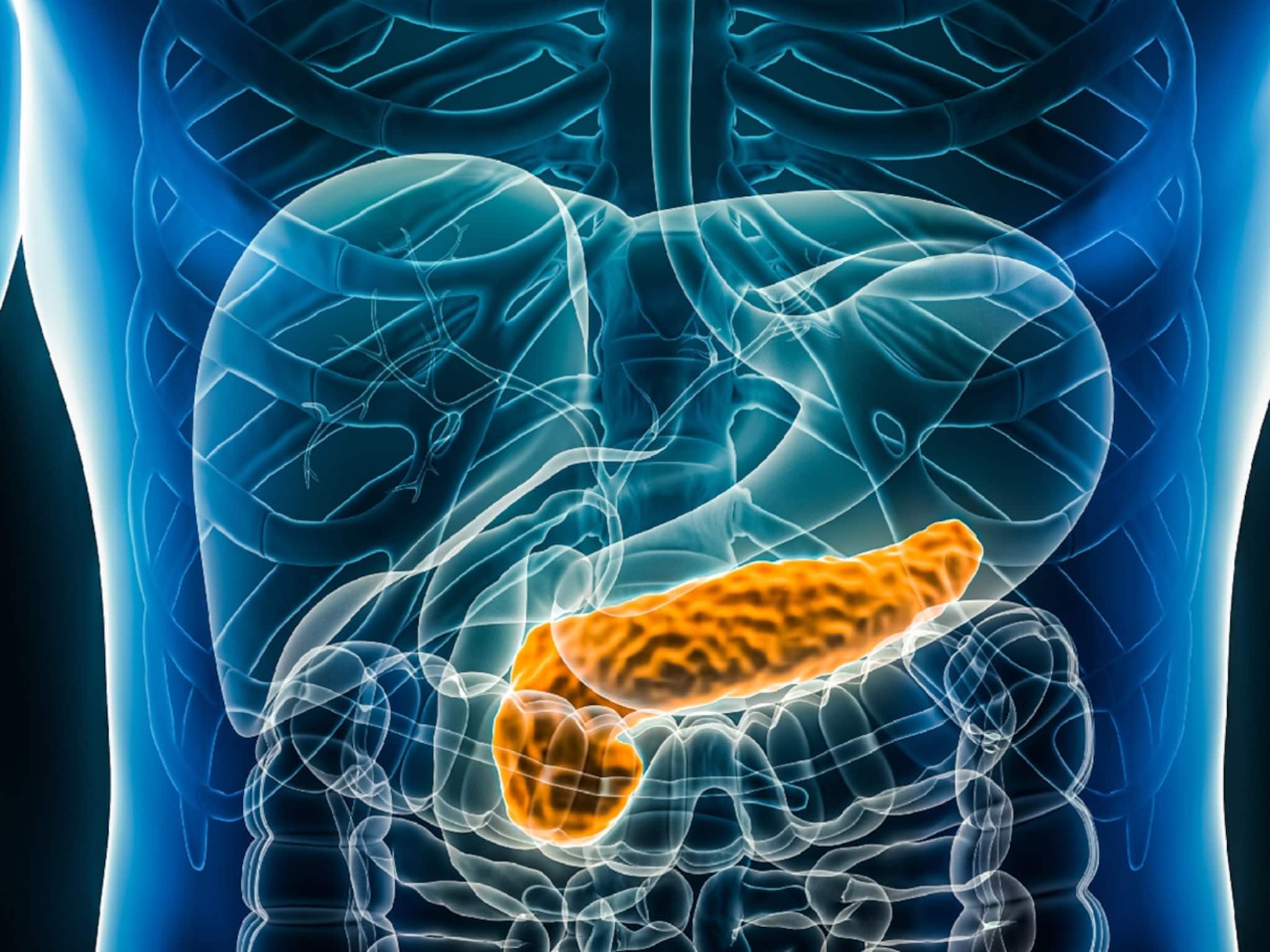 ,প্যানক্রিয়াটাইটিস মোকাবিলায় কী কী খাবেন, কী কী খাবেন না, পড়ুন ,প্যানক্রিয়াটাইটিস মোকাবিলায় কী কী খাবেন, কী কী খাবেন না, পড়ুন