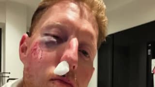 বেন স্টোকসের মুখে ভয়াবহ আঘাত Photo Courtesy- Instagram বেন স্টোকসের মুখে ভয়াবহ আঘাত Photo Courtesy- Instagram