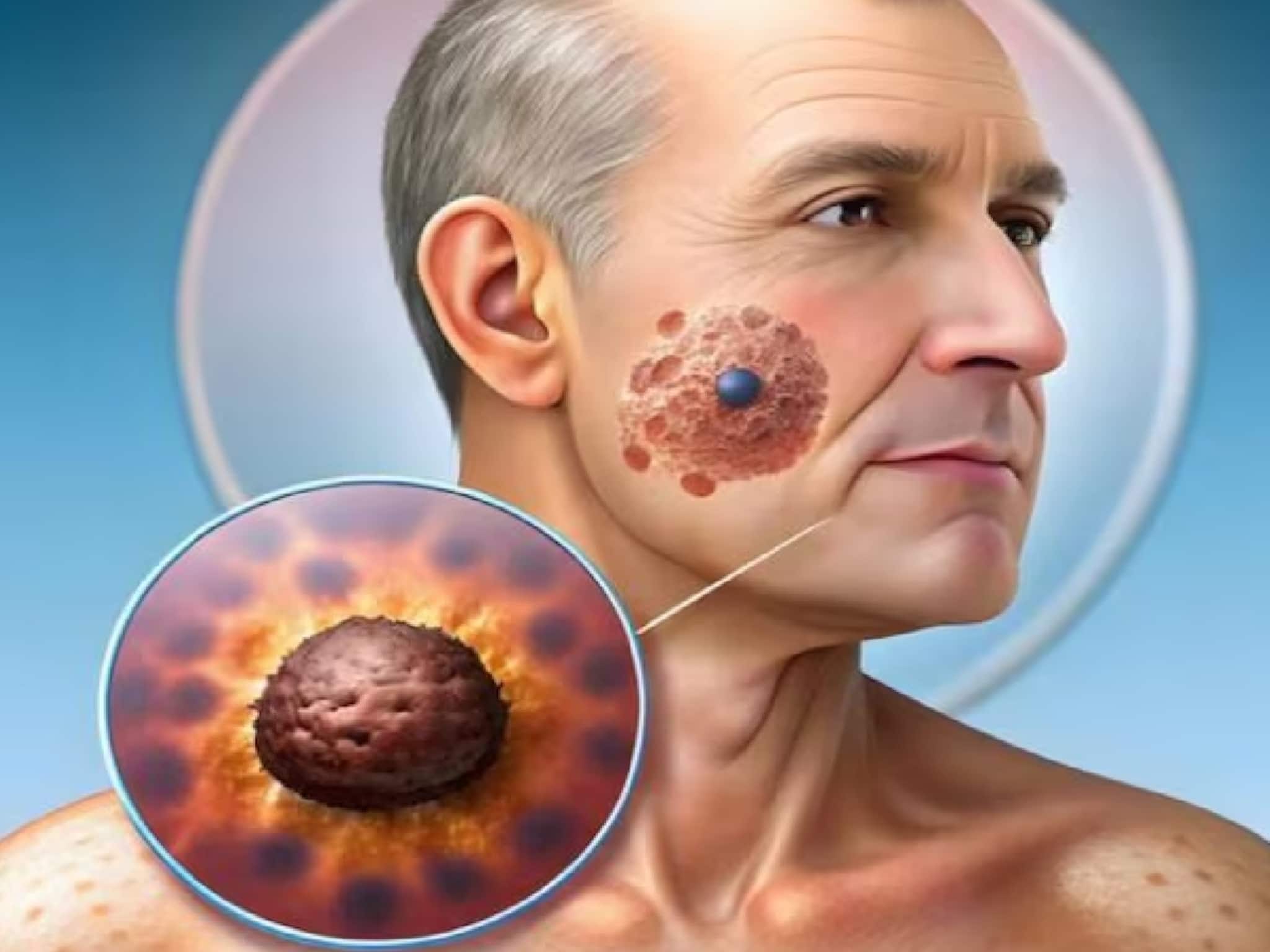 অজান্তেই শরীর কুরে কুরে খাচ্ছে মারণ ক্যানসার! 'এই' ৪ জিনিস জীবন থেকে বাদ দিন আজই