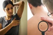 Stage 1 Cancer Symptoms: ক্যানসারের প্রথম পর্যায়: এই ৭ লক্ষণ উপেক্ষা করা উচিত নয়