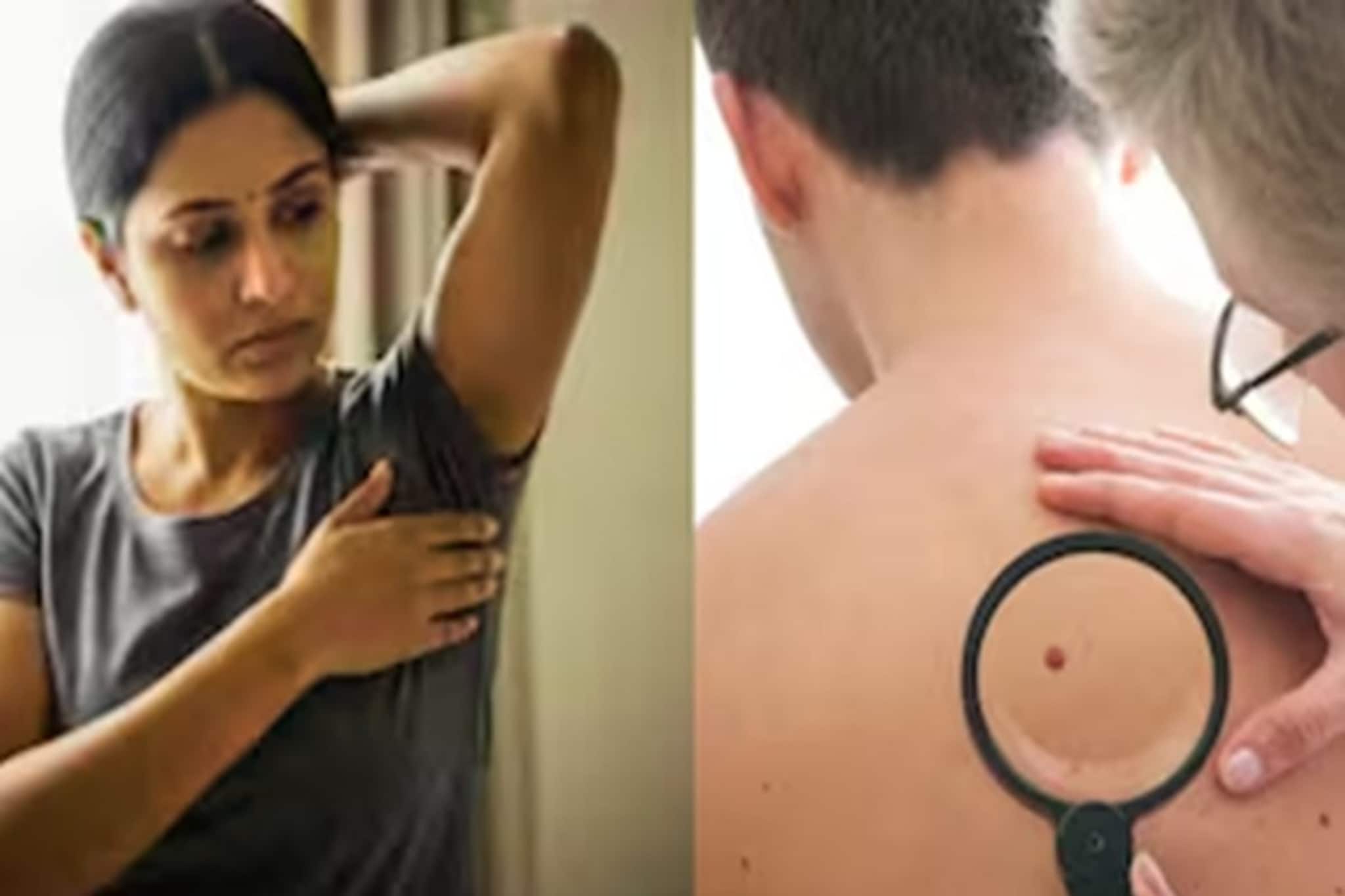 ক্যানসারের প্রথম পর্যায়: এই ৭ লক্ষণ উপেক্ষা করা উচিত নয়