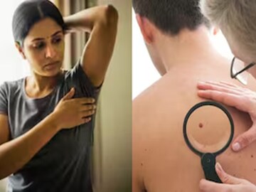 ক্যানসারের প্রথম পর্যায়: এই ৭ লক্ষণ উপেক্ষা করা উচিত নয়