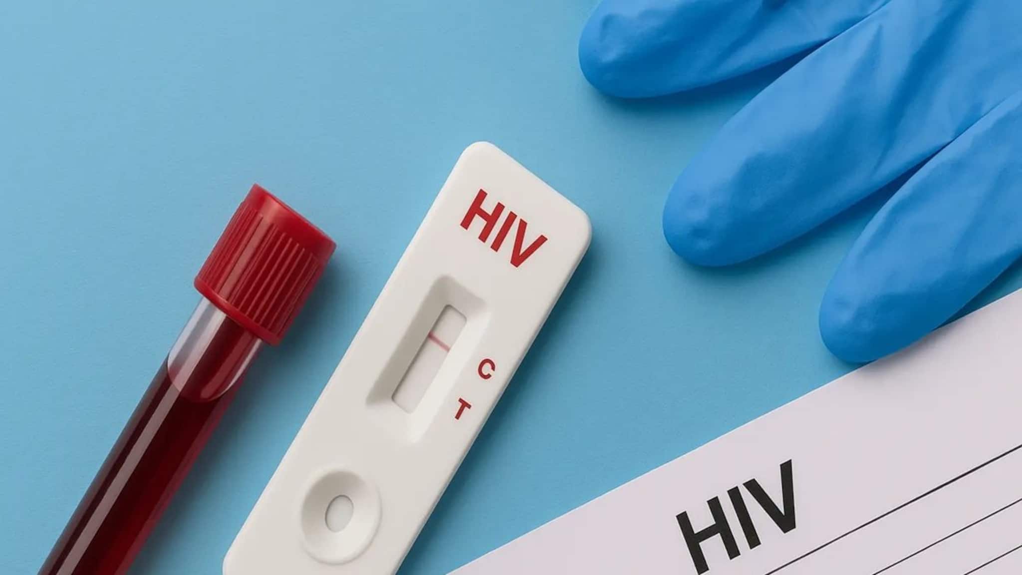 বর্ধমানে ৩০০-র বেশি HIV+! স্বাস্থ্য দফতরের কপালে চিন্তার ভাঁজ, আক্রান্ত পড়ুয়া-সমকামীরা