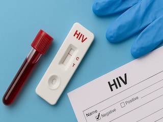 বর্ধমানে বাড়ছে এইচআইভি আক্রান্ত (প্রতীকী ছবি)