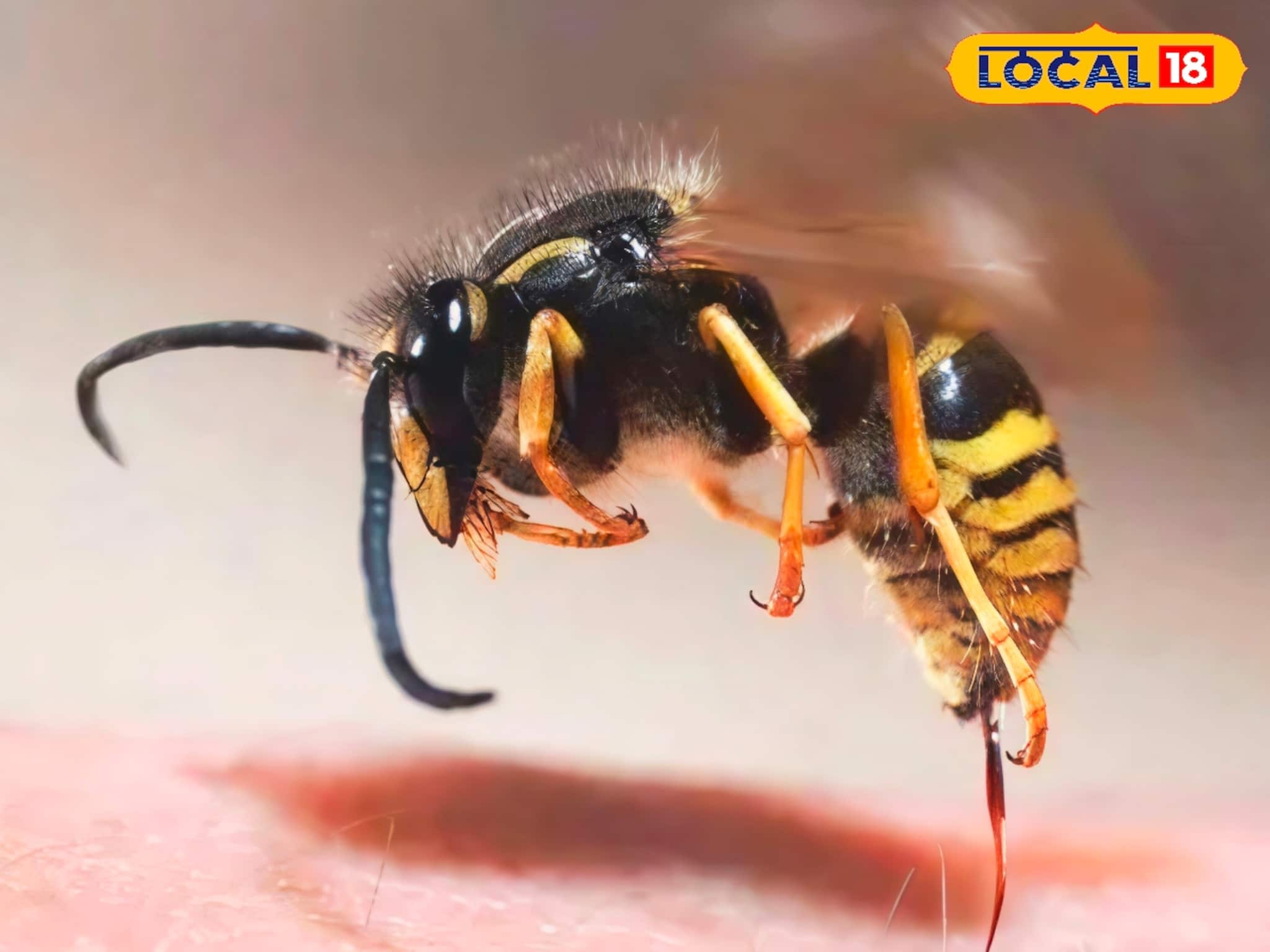 হুল ফোটানোর যন্ত্রণায় ছটফট করছেন? ঘরোয়া এই ৩টি উপায়ে নিমিষেই কমবে জ্বালা ও ফোলা