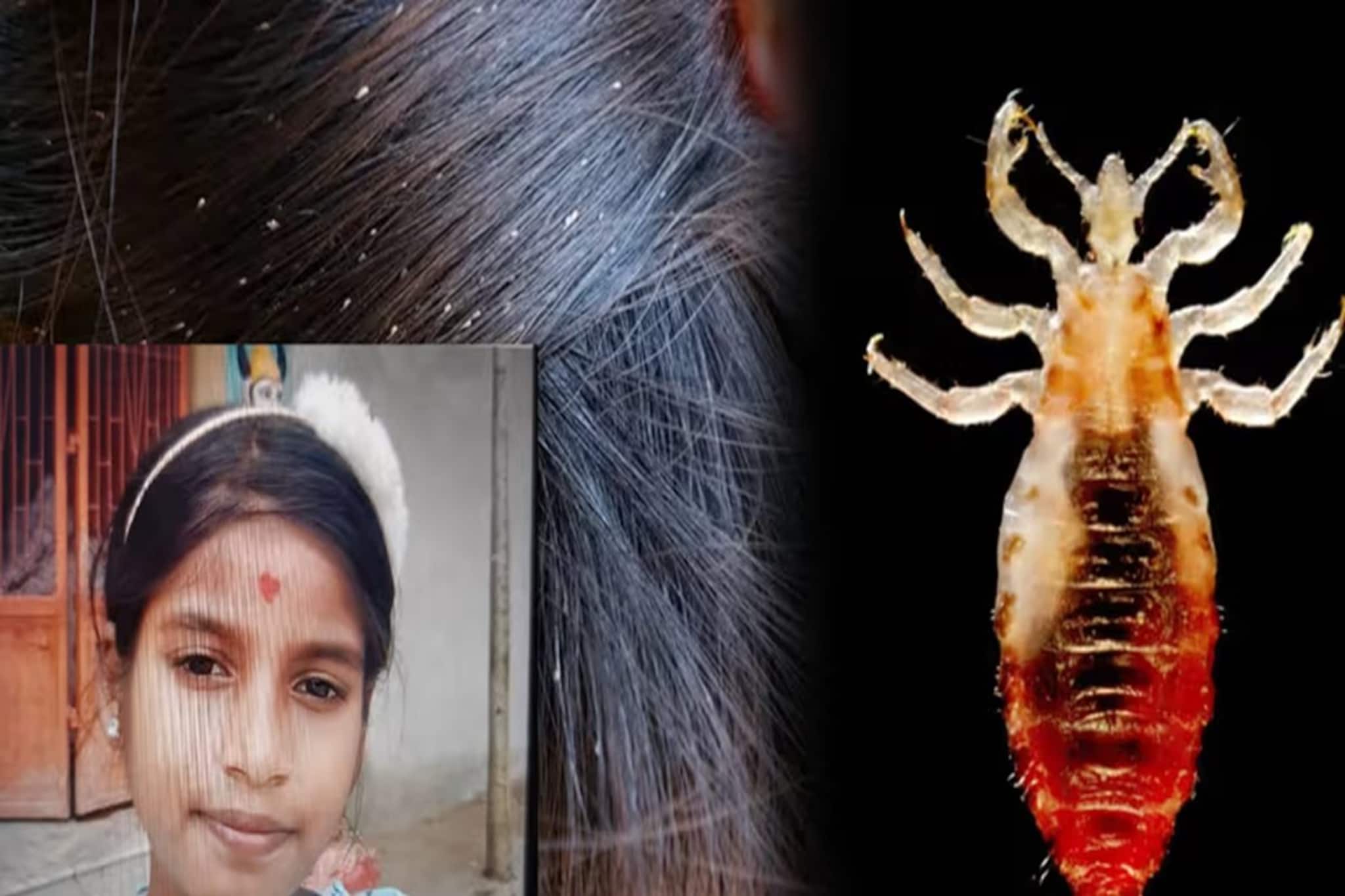 মাথায় উকুন ছোট্ট মেয়ের, সেখান থেকেই মৃত্যু! ভাবতে পারছেন! কী ভয়াবহ ঘটনা পুরীতে! যা ঘটল...