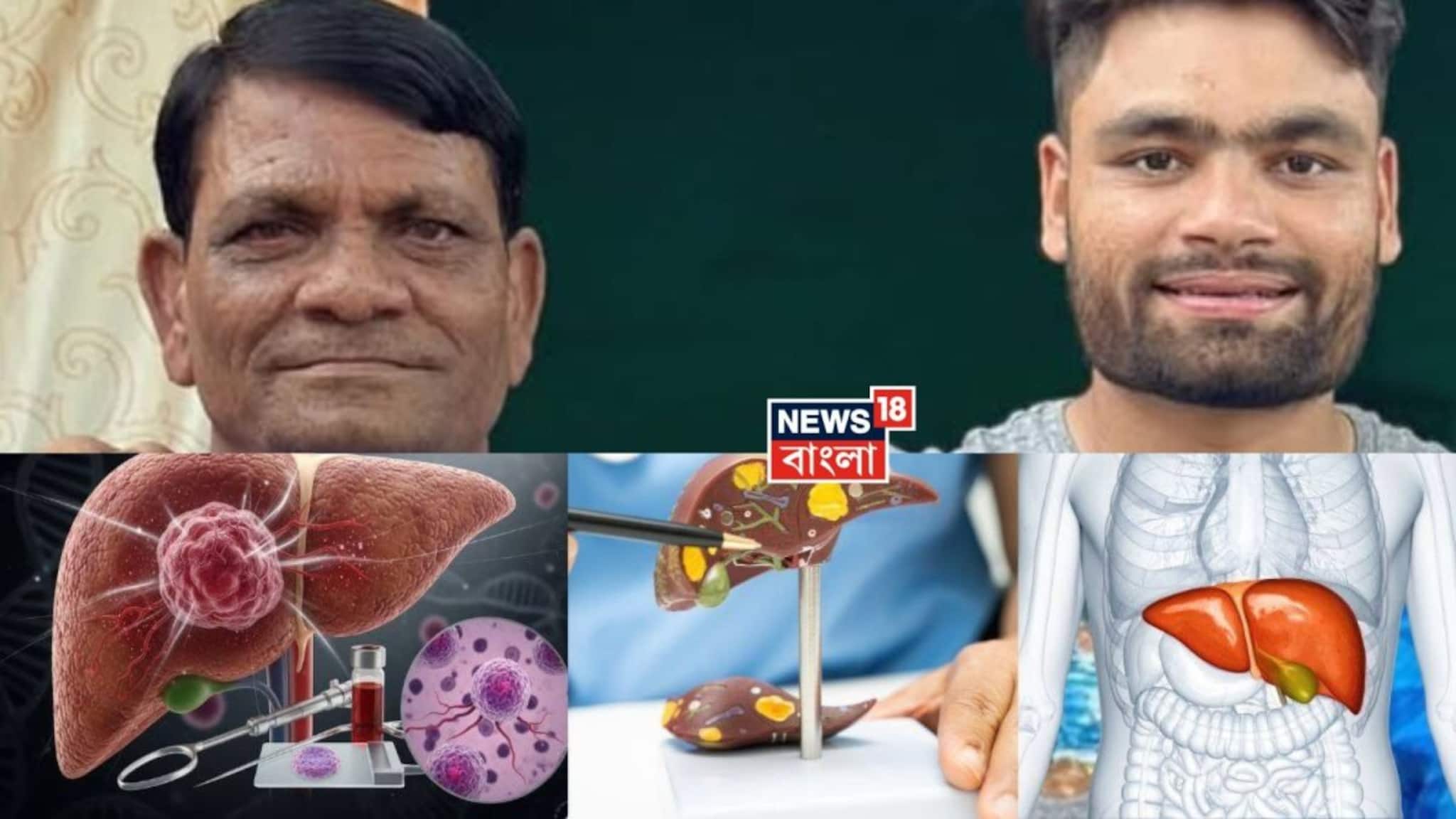 Detect Liver Cancer: চতুর্থ স্টেজ লিভার ক্যানসারে রিঙ্কু সিংয়ের বাবার মৃত্যু! মারণ এই রোগের প্রাথমিক লক্ষণ কী? কোন উপসর্গ দেখলেই চিকিৎসকের কাছে যাবেন? জানুন