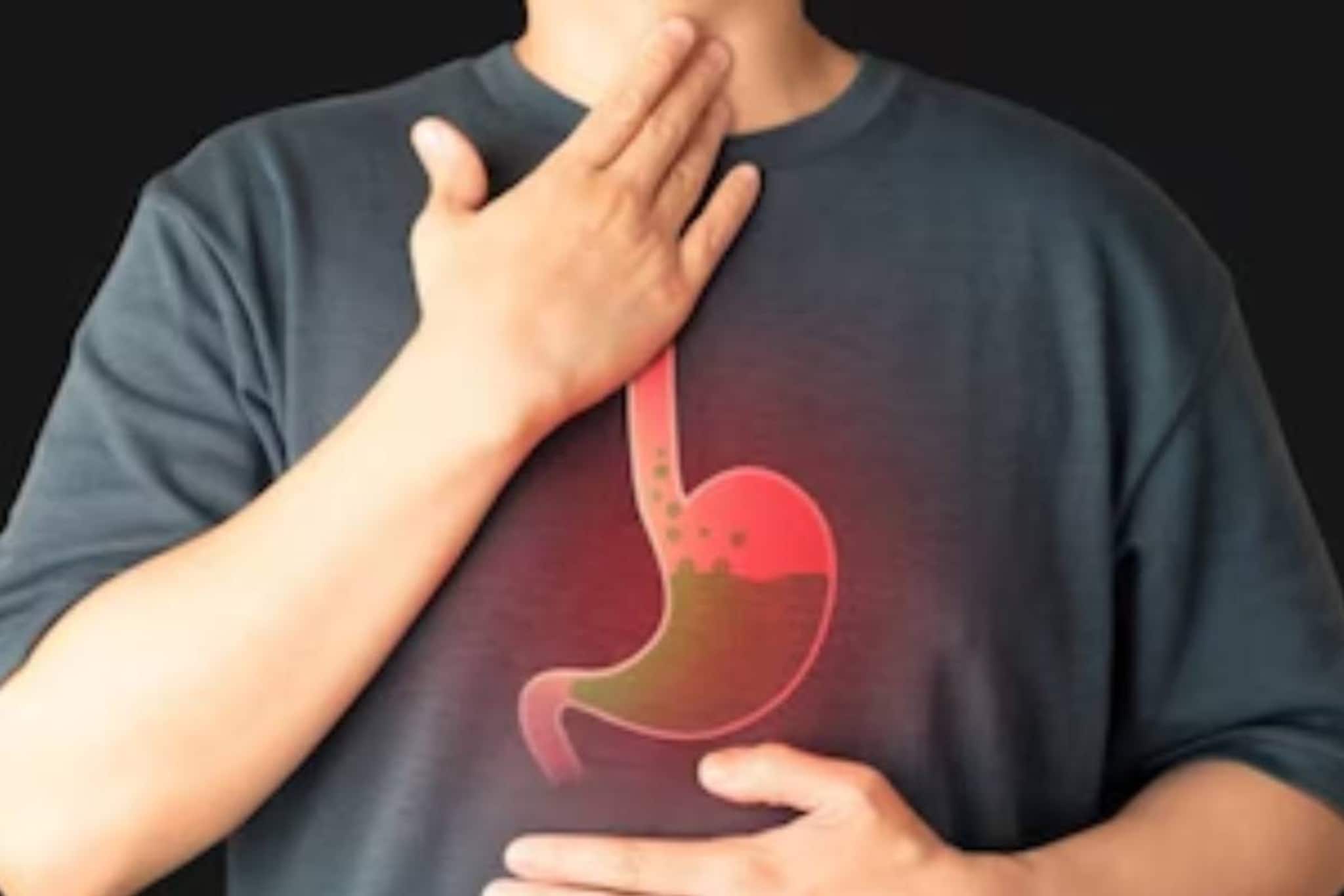 কিছু খেলেই অ্যাসিডিটিতে মুখ পুরো টক? অ্যান্টাসিড নয়! অম্বল সারান শুকনো আদা-মৌরির গুণে