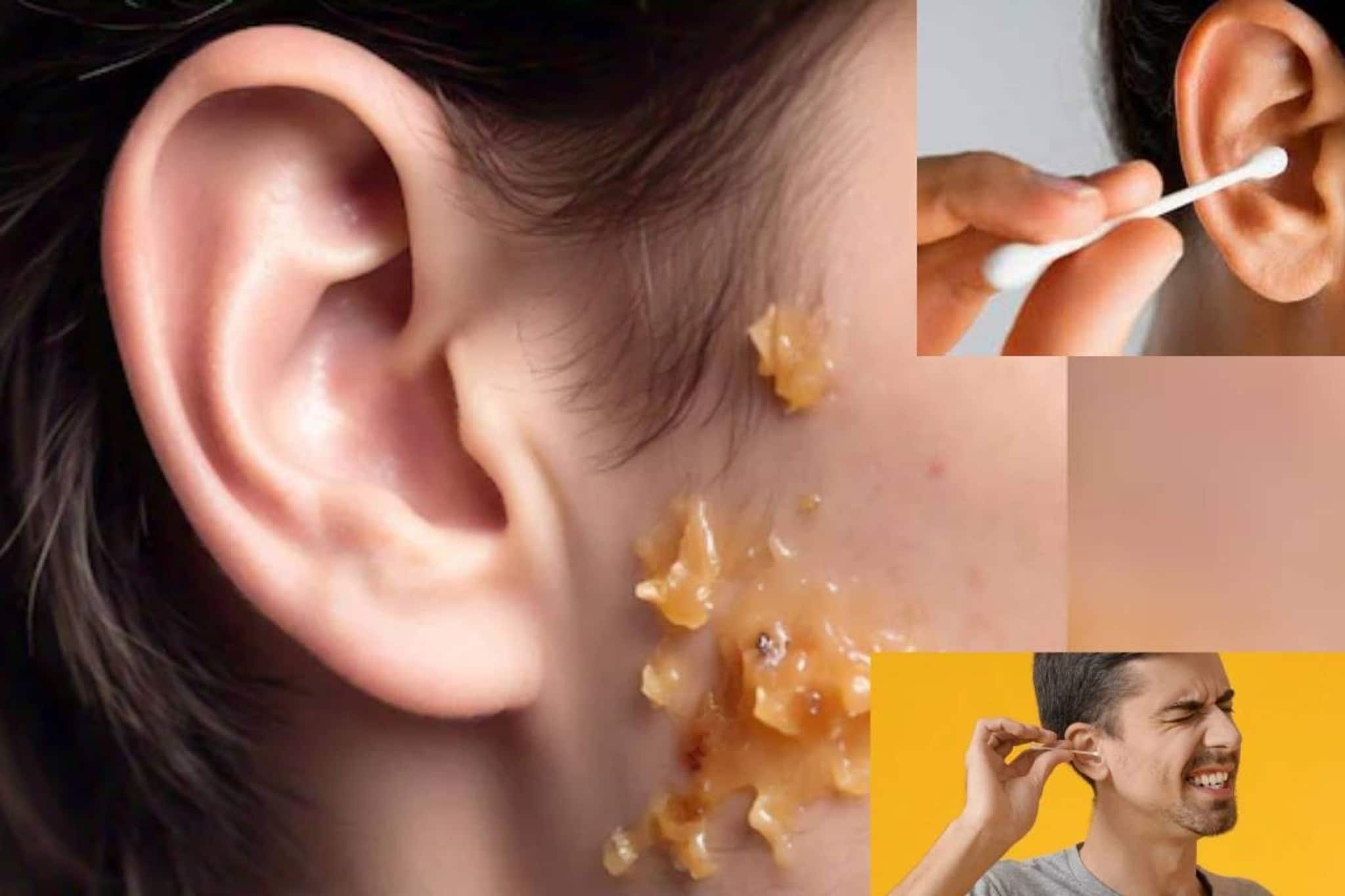 রসুনের সঙ্গে কয়েক ফোঁটা সরষে তেলের কামাল! জাদু টোটকায় গলগলিয়ে সাফ কানের খোল! রসুনের সঙ্গে কয়েক ফোঁটা সরষে তেলের কামাল! জাদু টোটকায় গলগলিয়ে সাফ কানের খোল!