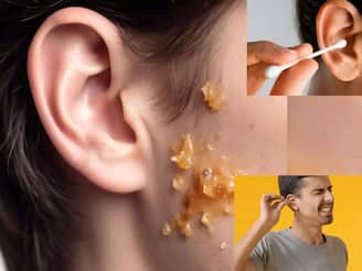 রসুনের সঙ্গে কয়েক ফোঁটা সরষে তেলের কামাল! জাদু টোটকায় গলগলিয়ে সাফ কানের খোল!