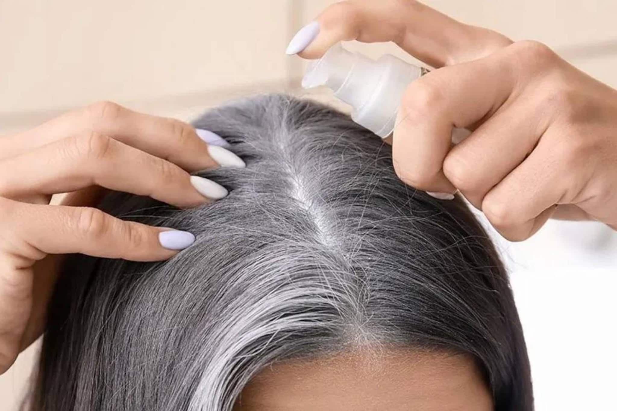 লাগবে না দামি কলপ-কালার! ১ মুঠো আমলকিতেই কালো হবে মাথাভর্তি পাকা চুল! কমবে চুল পড়া