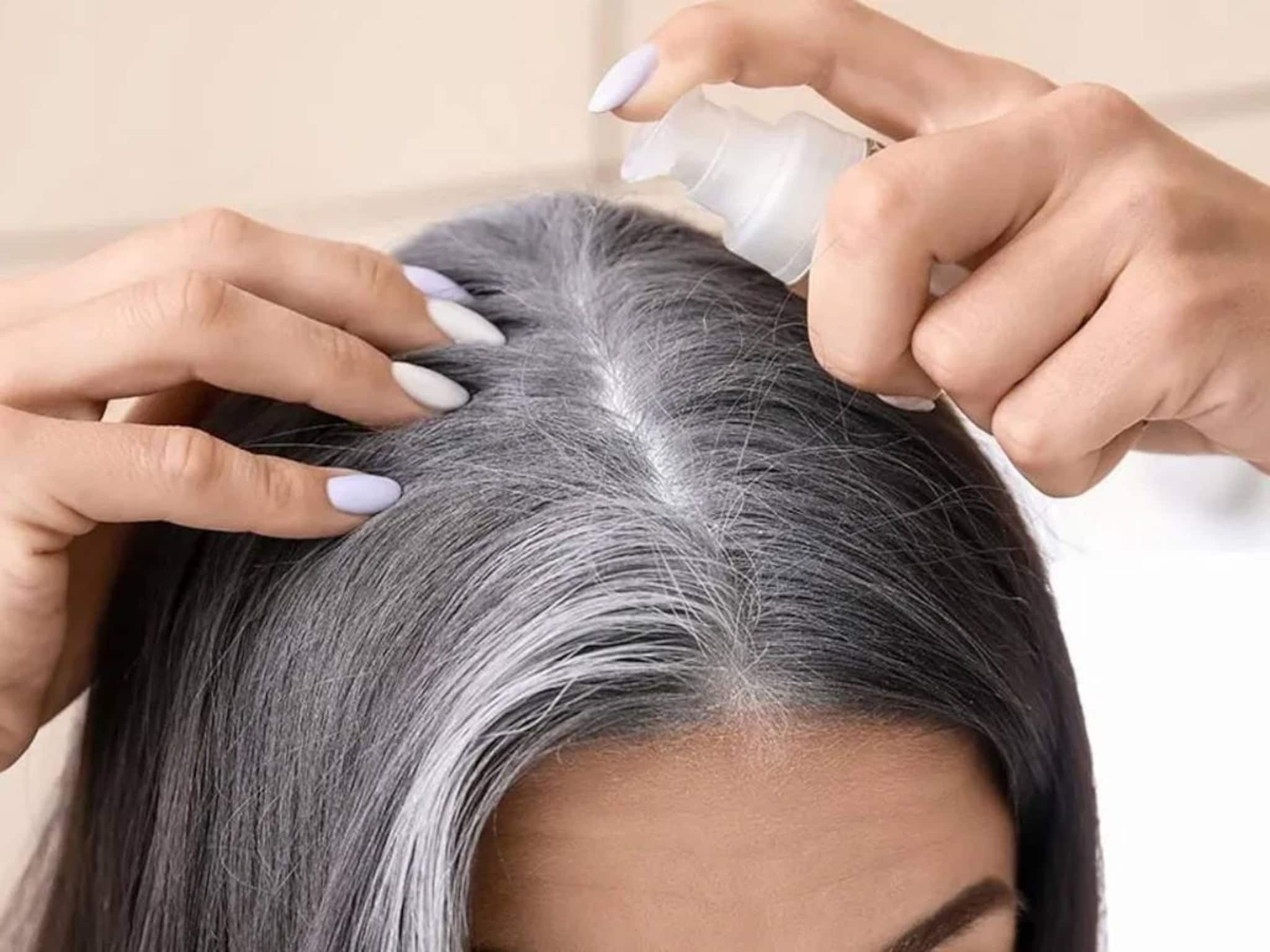 লাগবে না দামি কলপ-কালার! ১ মুঠো আমলকিতেই কালো হবে মাথাভর্তি পাকা চুল! কমবে চুল পড়া