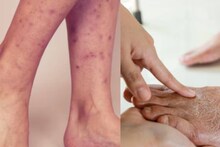 Leg Cleaning Tips: মধু-লেবুর কামাল! উঠে যাবে কালো ছোপ! ত্বকে থাকবে না একফোঁটা দাগও! পাবেন মাখনের মতো কোমল পা