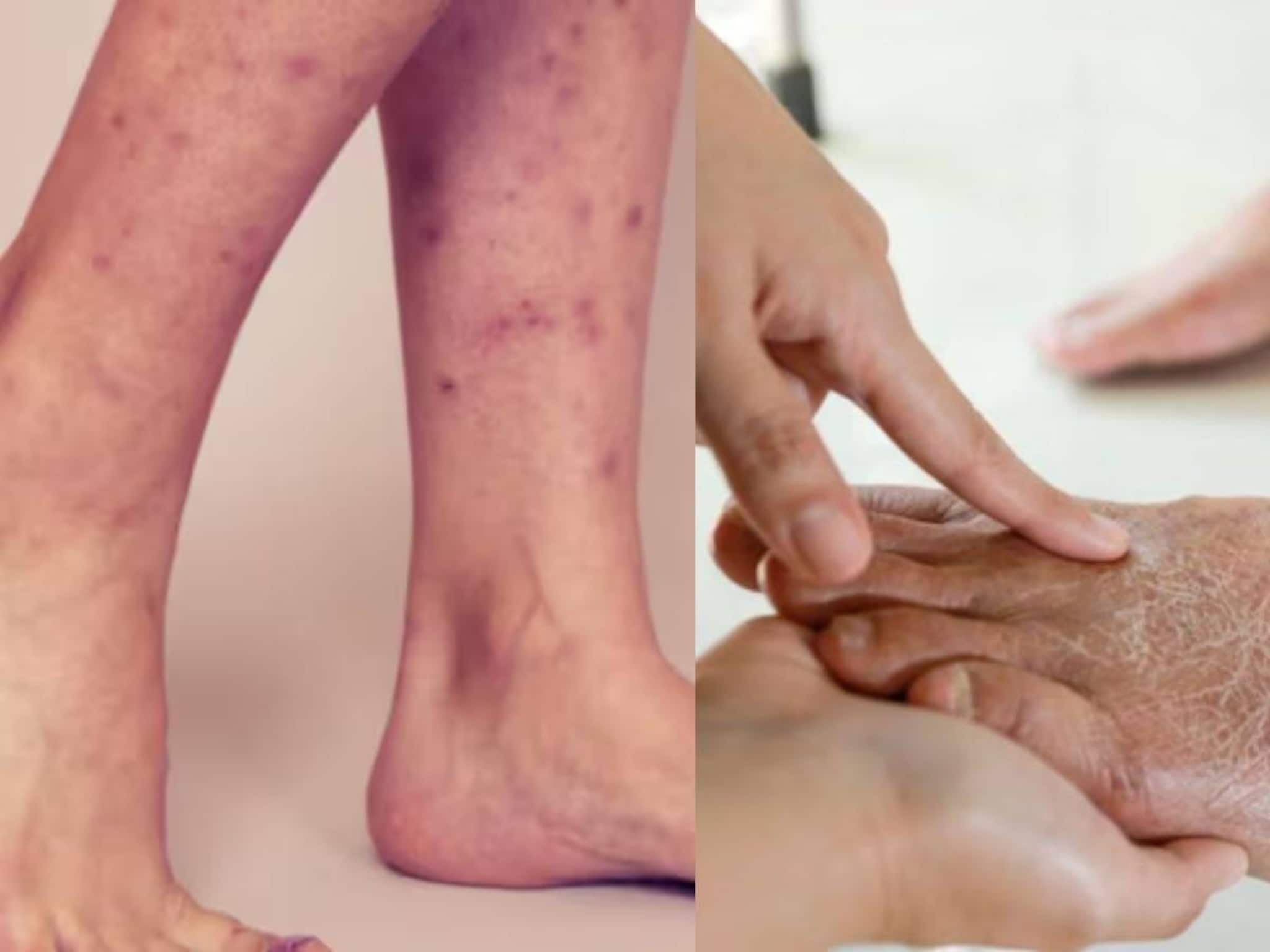 মধু-লেবুর কামাল! উঠে যাবে কালো ছোপ! ত্বকে থাকবে না একফোঁটা দাগও! পাবেন মাখনের মতো কোমল পা