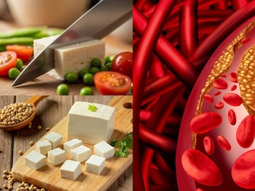 পনির খেলে হুড়মুড়িয়ে বাড়ে কোলেস্টেরল? কোন কোন রোগে ভুলেও দাঁতে কাটবেন না দুধের এই খাবার? পনির খেলে হুড়মুড়িয়ে বাড়ে কোলেস্টেরল? কোন কোন রোগে ভুলেও দাঁতে কাটবেন না দুধের এই খাবার?