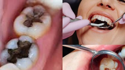 আধুনিক দন্তচিকিৎসা জোর দেয় যে আপনার মুখ আপনার শরীরের বাকি অংশের প্রবেশদ্বার আধুনিক দন্তচিকিৎসা জোর দেয় যে আপনার মুখ আপনার শরীরের বাকি অংশের প্রবেশদ্বার