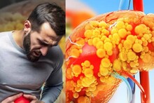 Liver Cirrhosis Symptoms: লিভার পচতে শুরু করার ৬ লক্ষণ! এগুলির একটাও আপনার হয়নি তো? আজই সতর্কতা নিন
