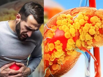 লিভার পচতে শুরু করার ৬ লক্ষণ! এগুলির একটাও আপনার হয়নি তো? আজই সতর্কতা নিন লিভার পচতে শুরু করার ৬ লক্ষণ! এগুলির একটাও আপনার হয়নি তো? আজই সতর্কতা নিন