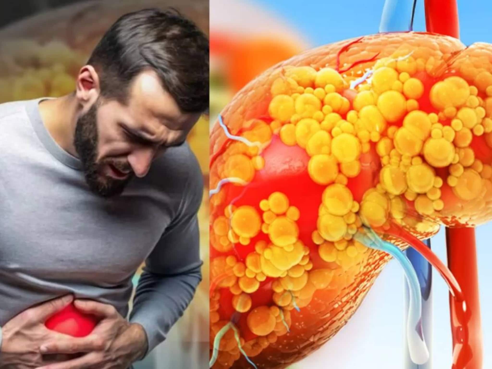 লিভার পচতে শুরু করার ৬ লক্ষণ! এগুলির একটাও আপনার হয়নি তো? আজই সতর্কতা নিন