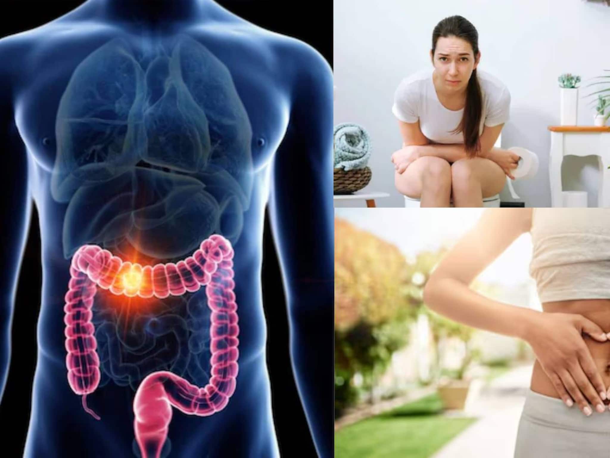 মুগডাল, পালংশাক, টক দই...৭ খাবারে গলগলিয়ে সাফ পেট! কোষ্ঠকাঠিন্যে চোখে জল আসার দিন শেষ!