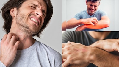 শরীরে ক্রমাগত চুলকানি কোনও ছোট সমস্যা নয়। যারা এতে ভোগেন তারাই জানেন যে এটি দিনের শান্তি এবং রাতের ঘুম উভয়কেই ব্যাহত করে। কখনও কখনও কোনও ফুসকুড়ি ছাড়াই, ত্বকে চুলকানি শুরু হয় এবং ব্যক্তি বারবার একই জায়গায় আঁচড় দিতে থাকে।