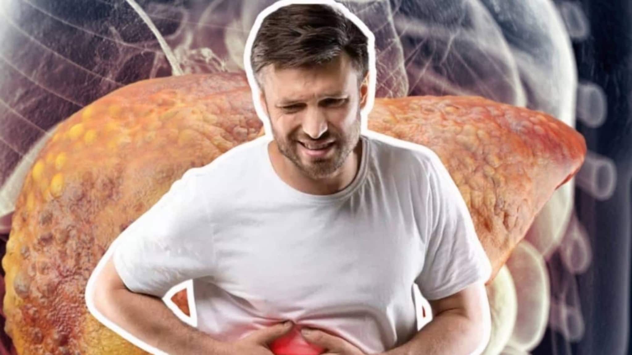 Food to cause Fatty Liver: তেল-ঘি-অ্যালকোহল নয়! এই ২ খাবারেই বদ চর্বি বেশি জমে লিভারে! ফ্যাটি লিভারের খলনায়ক