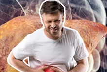 Food to cause Fatty Liver: তেল-ঘি-অ্যালকোহল নয়! এই ২ খাবারেই বদ চর্বি বেশি জমে লিভারে! ফ্যাটি লিভারের খলনায়ক