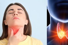 Thyroid Prevention: কম দামি সবজির বীজ জাস্ট ১ চামচ! দিনের এই সময়ে এভাবে খেলেই থাইরয়েড সমস্যার দফারফা!
