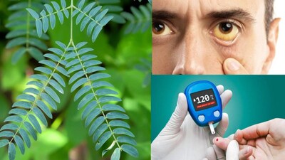 Tamarind Leaves: Ancient Remedy for Jaundice, Diabetes, Joint Pain & More
