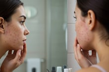 Skin Problem Remedies: ৪ পাহাড়িয়া গাছ থেকে তৈরি ভেষজ মলম! ম্যাজিকের মতো সারবে চুলকানি-জ্বালাপোড়া-সহ ত্বকের সব সমস্যা