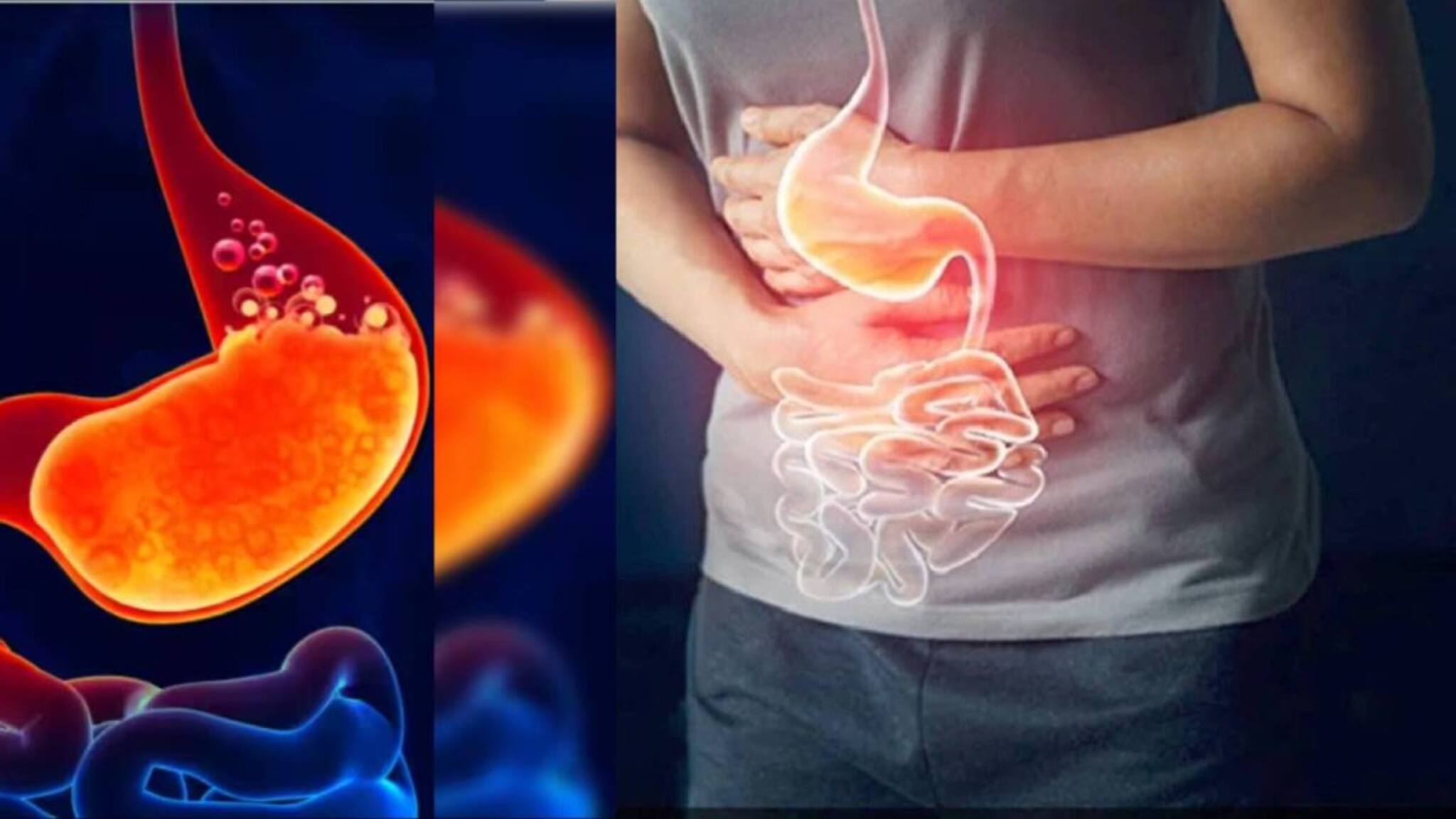 Constipation Home Remedies: লাগবে না দামি ওষুধ! এই ছোট্ট ৫ কাজেই কমবে কোষ্ঠকাঠিন্যের কষ্ট! পেটের নোংরা বার হবে গলগলিয়ে