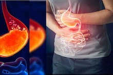 Constipation Home Remedies: লাগবে না দামি ওষুধ! এই ছোট্ট ৫ কাজেই কমবে কোষ্ঠকাঠিন্যের কষ্ট! পেটের নোংরা বার হবে গলগলিয়ে