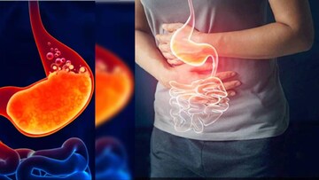 লাগবে না দামি ওষুধ! এই ছোট্ট ৫ কাজেই কমবে কোষ্ঠকাঠিন্যের কষ্ট! পেটের নোংরা সাফ গলগলিয়ে