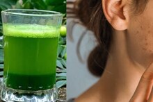 Pimple Home Remedy: সকালে খালি পেটে চুমুক দিন এই সবুজ পানীয়ে, ৭ দিনে পালাবে জেদি ব্রণ! উধাও গর্ত-কালো দাগছোপ
