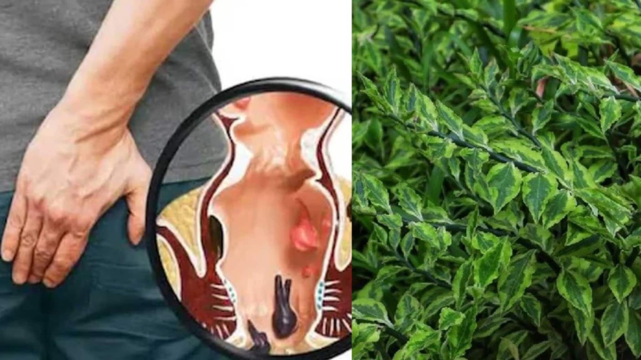 Piles Home Remedies: টানা ৩ দিন রোজ এই বিশেষ গাছের পাতা গুনে গুনে ৫ টা! খেলেই আরাম অর্শের রক্তপাত, জ্বালাপোড়া ও যন্ত্রণায়