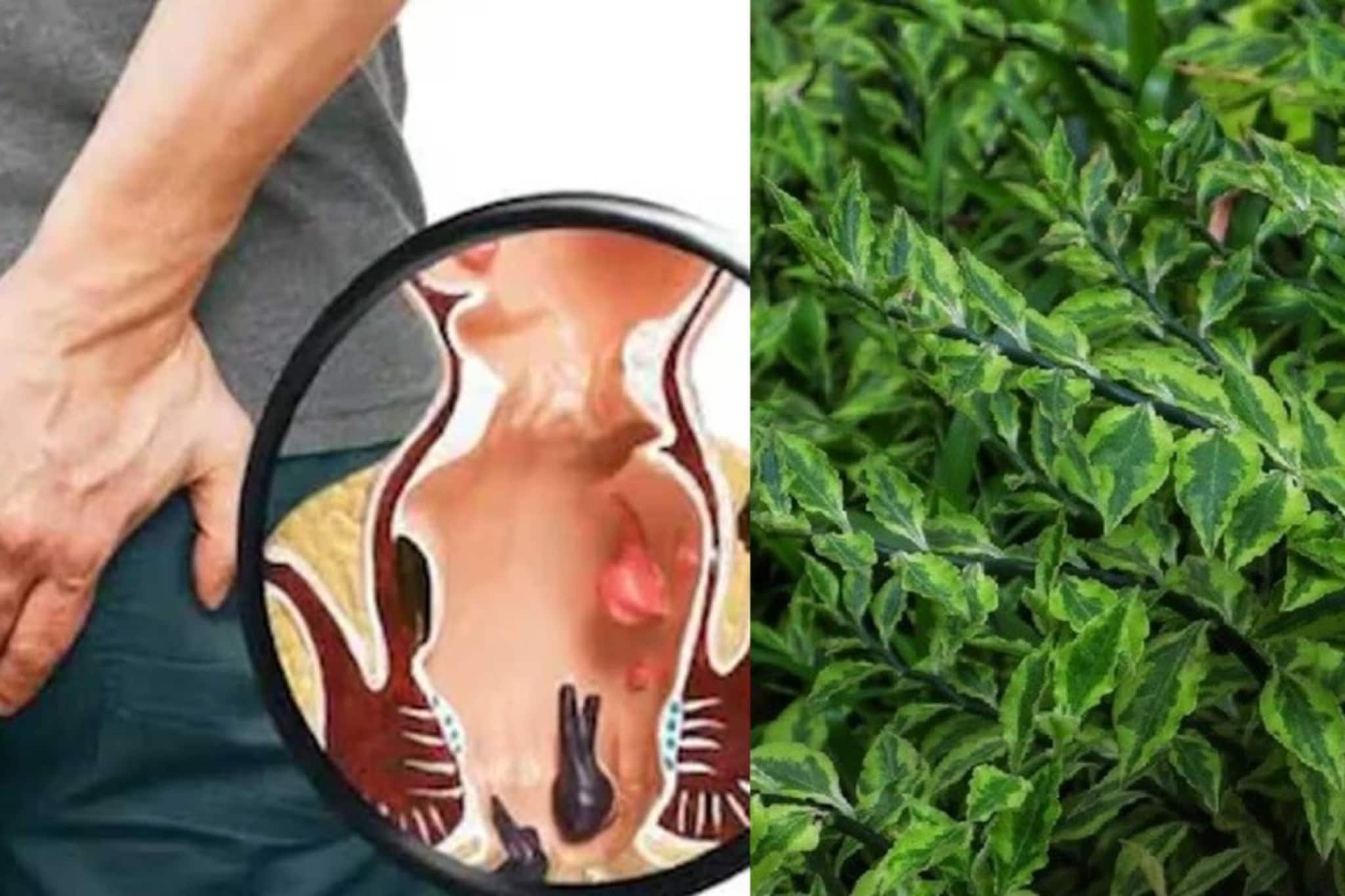 টানা ৩ দিন রোজ এই বিশেষ গাছের পাতা গুনে গুনে ৫ টা! খেলেই আরাম অর্শের রক্তপাত, জ্বালাপোড়ায়