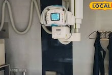 Purulia News: পুরুলিয়ার স্বাস্থ্যক্ষেত্রে স্বস্তির খবর! দেবেন মাহাতো মেডিক্যাল কলেজে ফের চালু হল সিটি স্ক্যান পরিষেবা, মিটল দুর্ভোগ