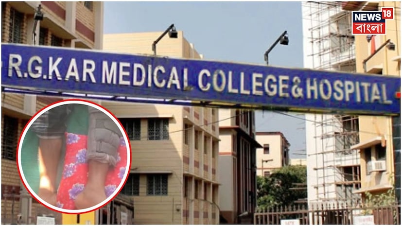 কলকাতা: আরজি কর মেডিক্যাল কলেজ হাসপাতালের অসাধ্য সাধন! পূর্ব ভারতে প্রথম হাড় প্রতিস্থাপন করে নজির গড়ল আরজি কর। সম্পূর্ণ বিনামূল্যে বেনজির অস্ত্রোপচারে উপকার পেলেন উত্তর ২৪ পরগনার বিড়ার বাসিন্দা ৩১ বছর বয়সি যুবক রিজাউদ্দিন মণ্ডল। কলকাতা: আরজি কর মেডিক্যাল কলেজ হাসপাতালের অসাধ্য সাধন! পূর্ব ভারতে প্রথম হাড় প্রতিস্থাপন করে নজির গড়ল আরজি কর। সম্পূর্ণ বিনামূল্যে বেনজির অস্ত্রোপচারে উপকার পেলেন উত্তর ২৪ পরগনার বিড়ার বাসিন্দা ৩১ বছর বয়সি যুবক রিজাউদ্দিন মণ্ডল।