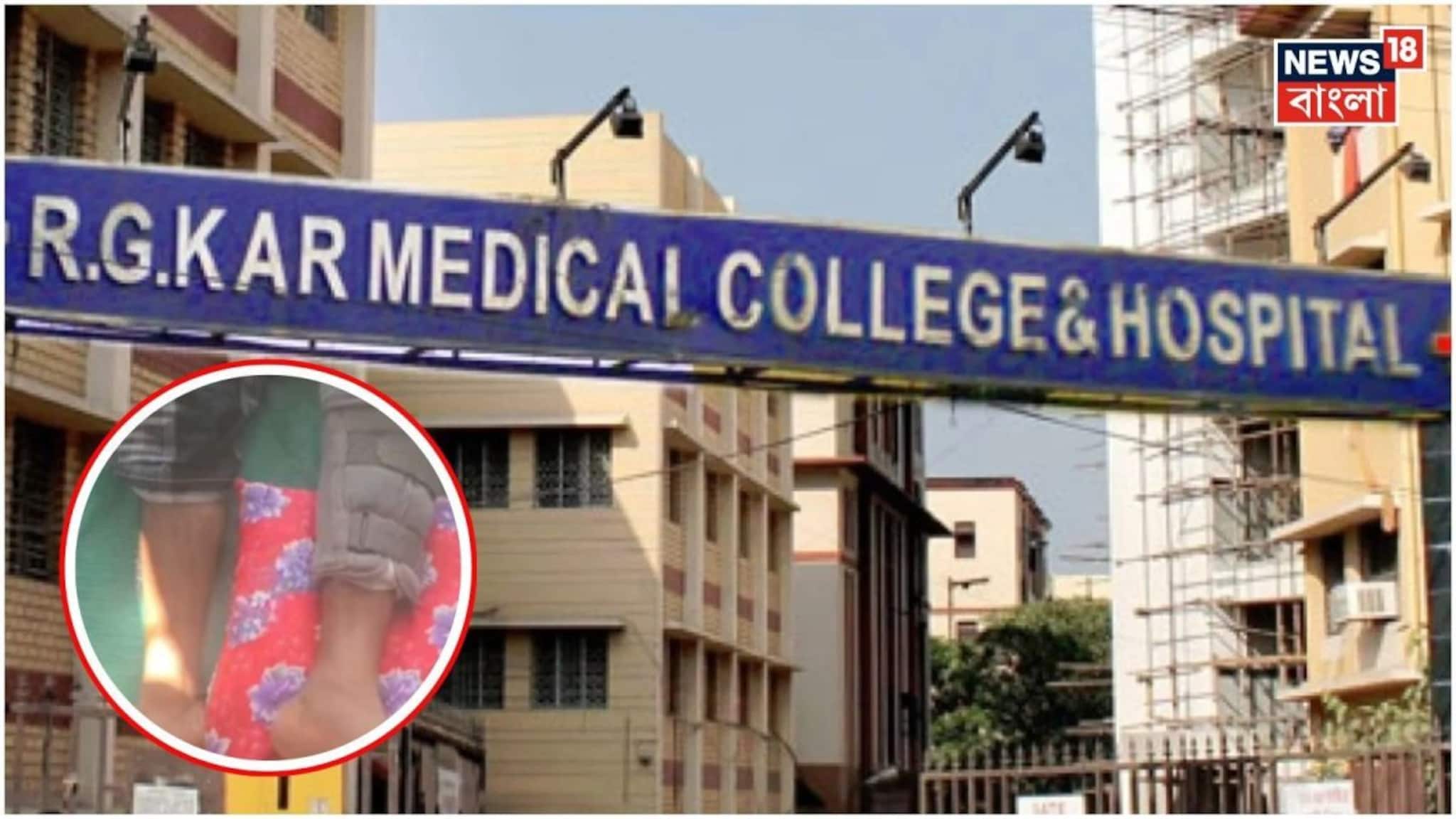 আরজি করের নজিরবিহীন সাফল্য...! মৃত ব্যক্তির হাড় জুড়ল 'বিনামূল্যে', পূর্ব ভারতে প্রথম 'হাড়' প্রতিস্থাপন, পা ফিরে পেলেন রোগী