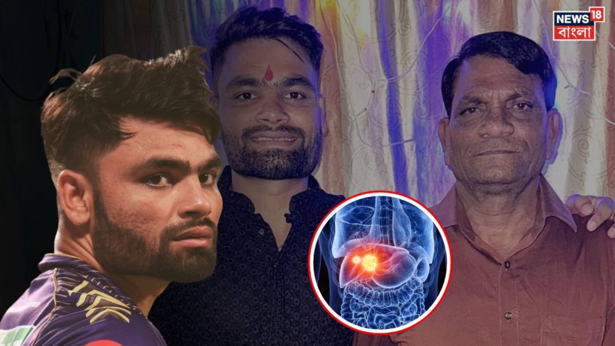 4th Stage Liver Cancer Symptoms: রিঙ্কুর বাবার চতুর্থ স্টেজের লিভার ক্যানসার কি আদৌ সারে, এই মারণ রোগ কম থাকতেই শরীরে লক্ষণ দেখায়, চিনুন সেই লক্ষণ