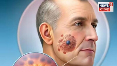 कम उम्र में कैंसर की चेतावनी: 4 बुरी आदतें जो चुपचाप शरीर को खा रही हैं