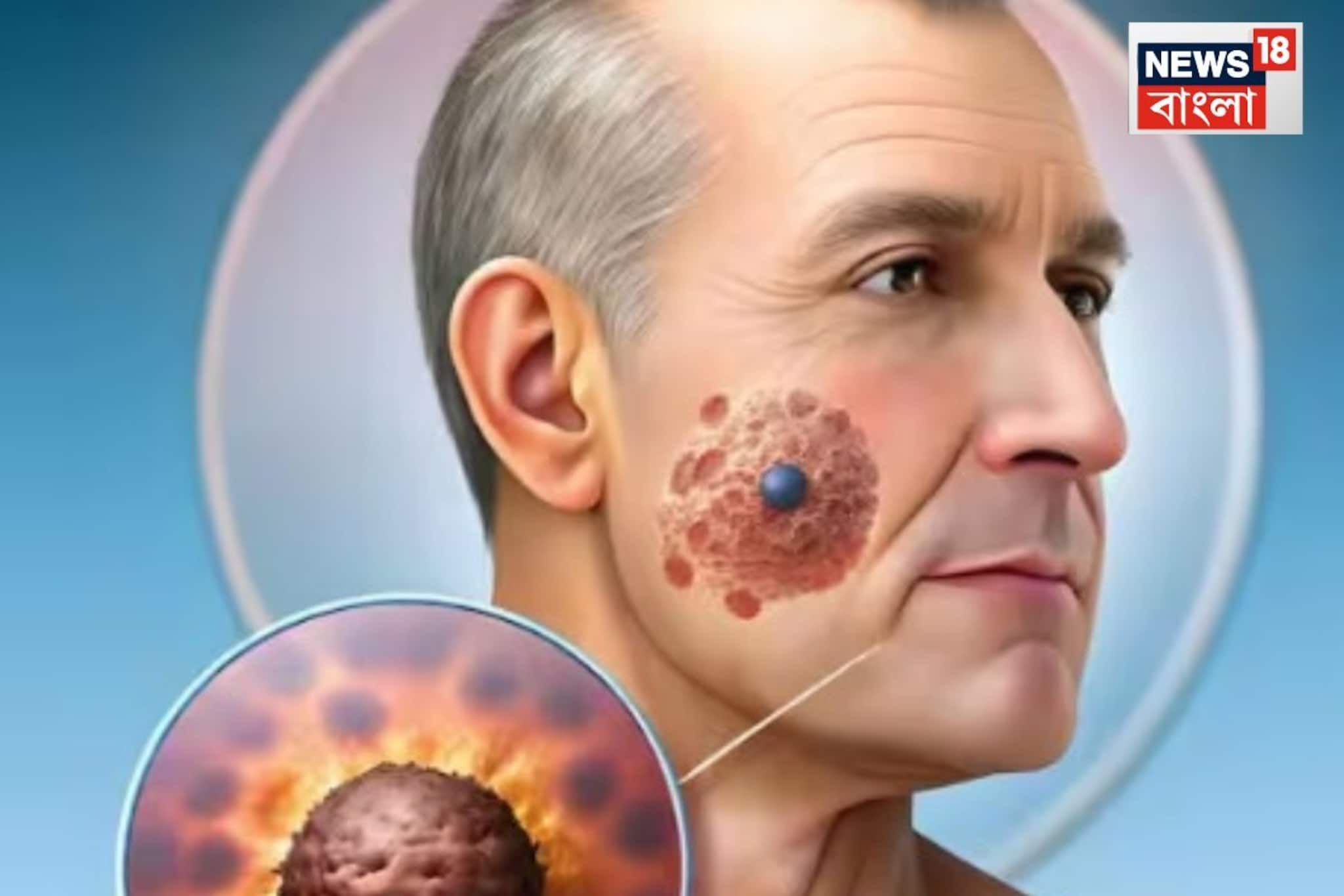 অজান্তে শরীর 'খাচ্ছে' ক্যানসার,প্রতিদিনের এই ৪ 'বদ অভ্যাস' যত তাড়াতাড়ি ছাড়বেন ততই মঙ্গল