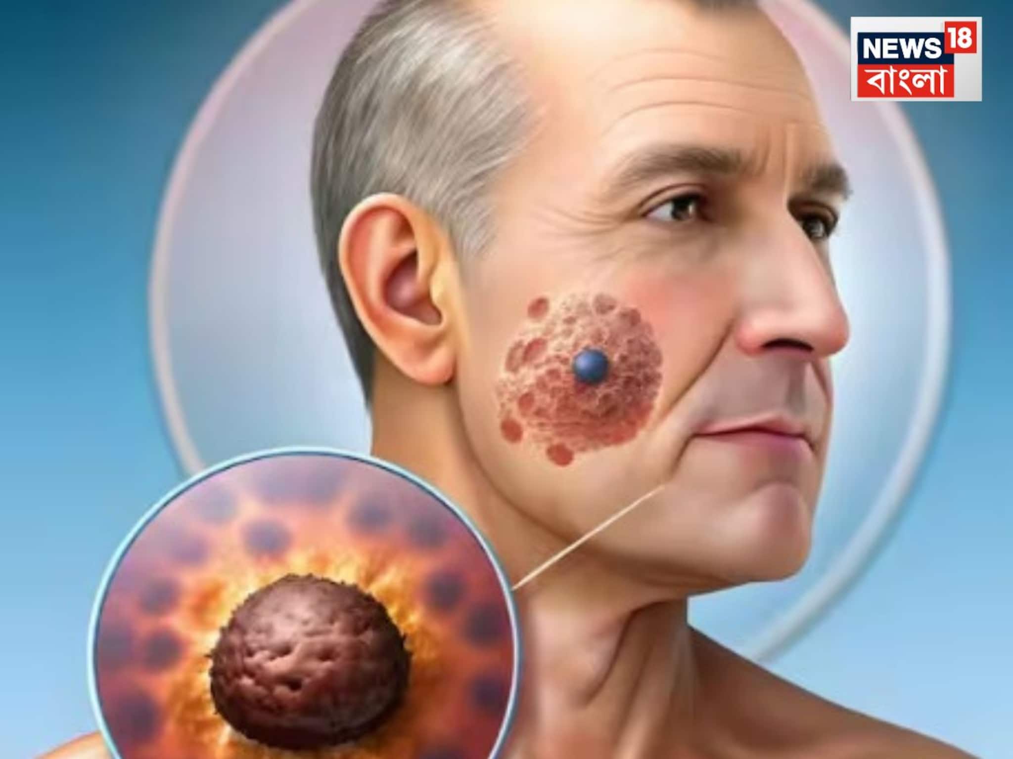 অজান্তে শরীর 'খাচ্ছে' ক্যানসার,প্রতিদিনের এই ৪ 'বদ অভ্যাস' যত তাড়াতাড়ি ছাড়বেন ততই মঙ্গল