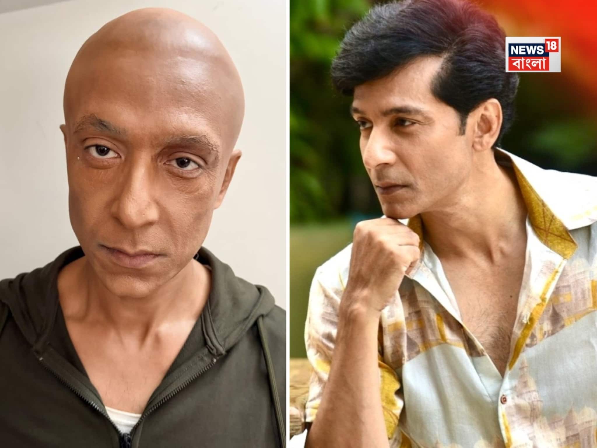 চুল-দাড়ি কামিয়ে নিষ্পলক বিষণ্ণ মুখ! 'দু'মুখো' টোটাকে দেখে হতবাক ভক্তরা, ব্যাপারটা কী?