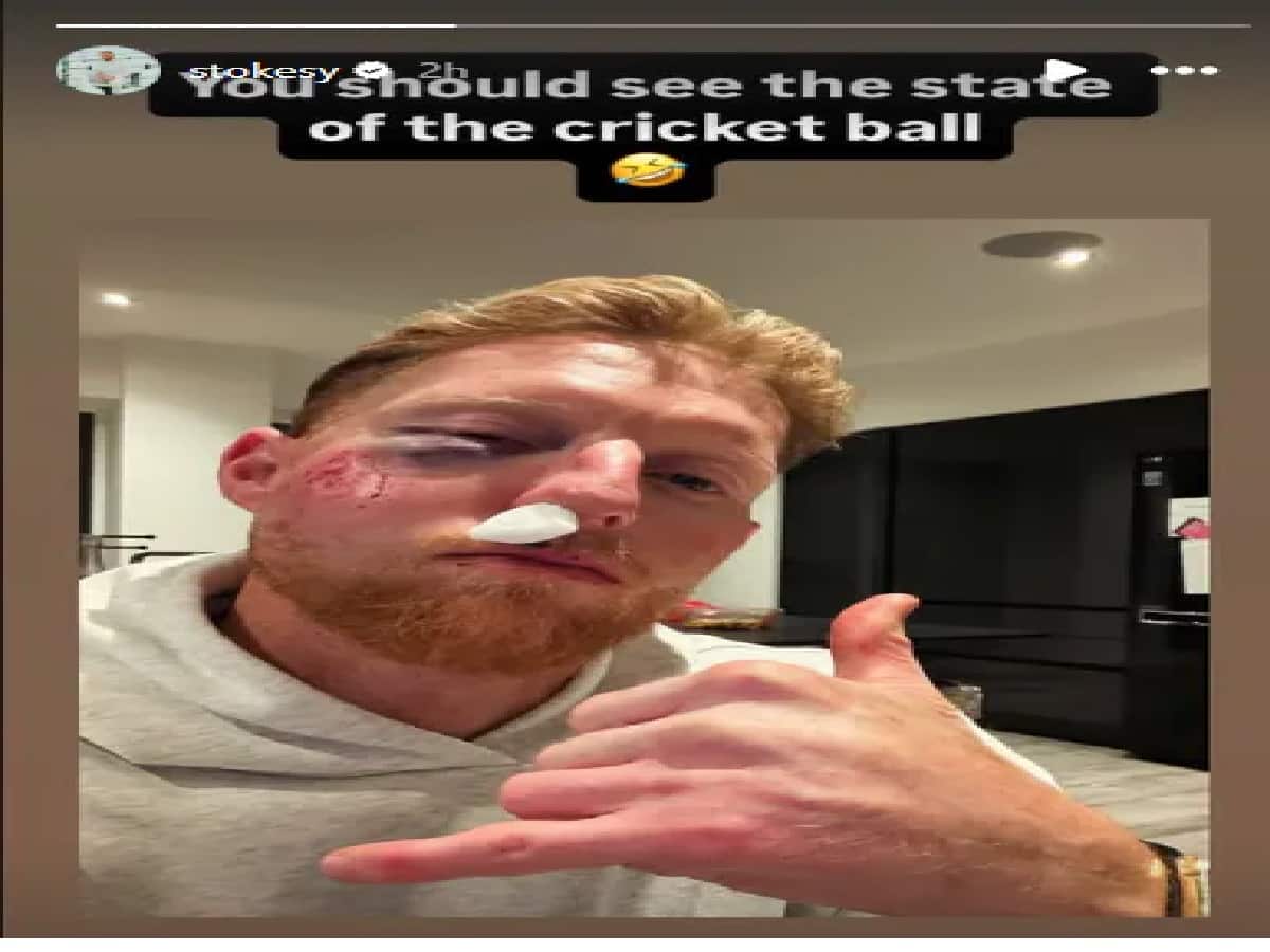 বেন স্টোকসের চোট 